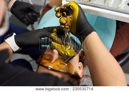 Close-up Of A Stomatologist In Black Gloves Cures A Patient With A Cofferdam And Special Glasses. Th