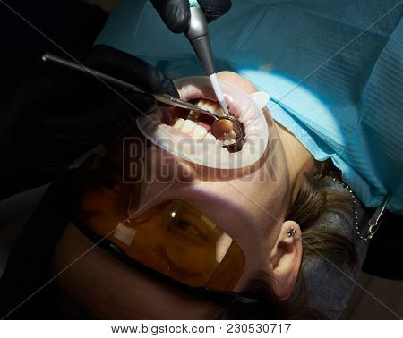 Close-up Of Medical Dentist Procedure Teeth Polishing In Modern Clinic. The Concept Of Modern Stomat