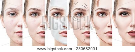 Beautiful Woman Step By Step Improves Her Skin Condition. Skin Care Concept.