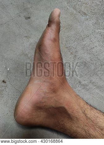 Man's Foot Hair Photos Background Blur And Selective Focus