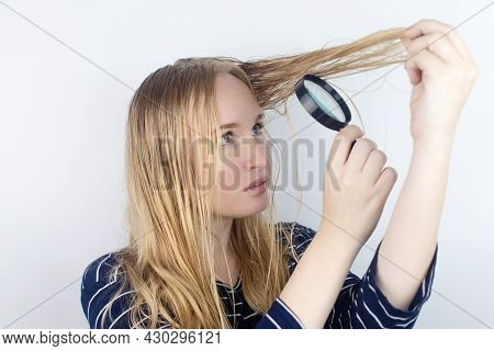 The Girl Looks In Front Of The Magnifier At Her Oily Hair. Problematic Scalp And Increased Secretion