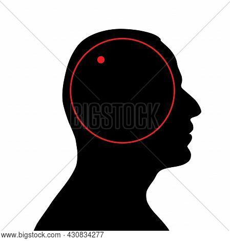 Imbalance Of Consciousness. Illustration Of The Imbalance Of Consciousness As A Symbol Of The Spirit
