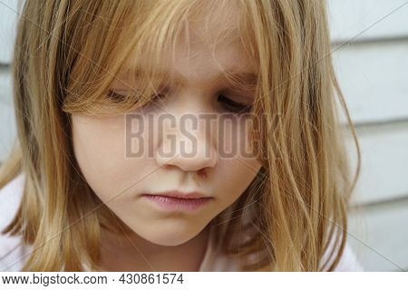 Portrait Girl With An Abrasion Under Her Eye. Child Abuse. Wounds And Abrasions