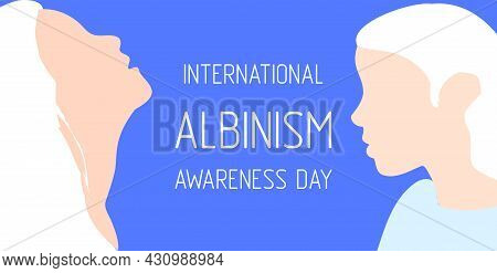 International Albinism Awareness Day, Woman With White Hair