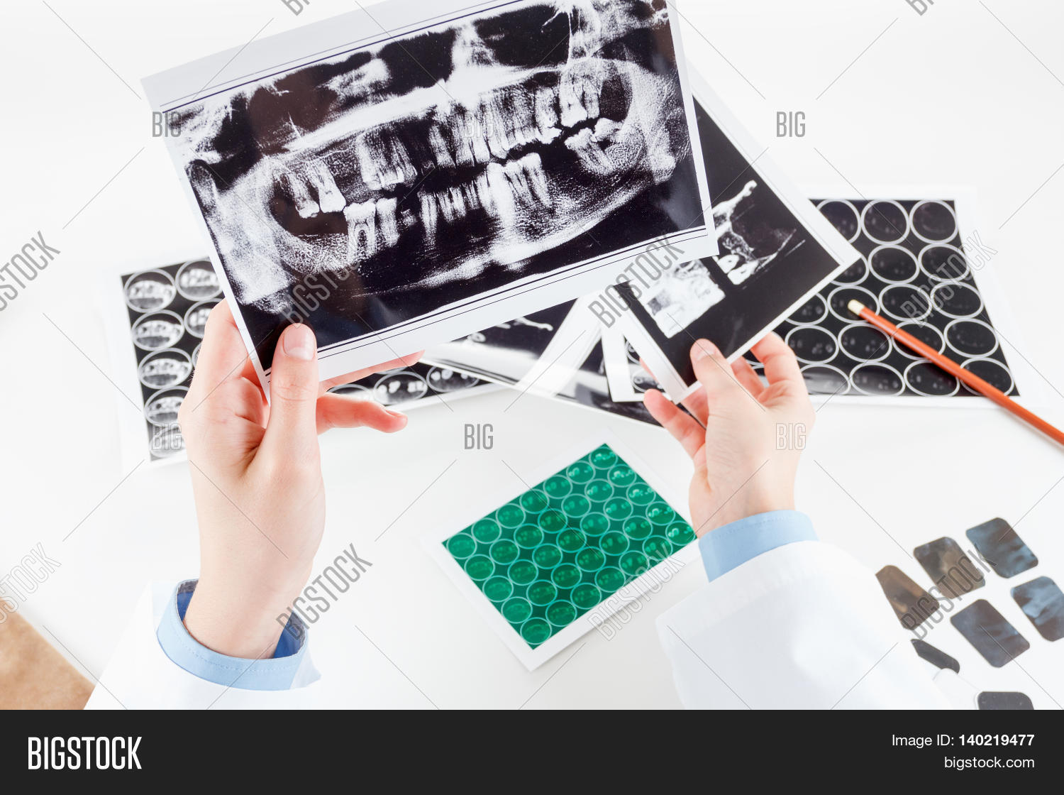 Panoramic Xray Jaw. Image & Photo (Free Trial) Bigstock