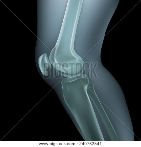 Realistic X-ray Shots.image Uses A Grid Gradient.