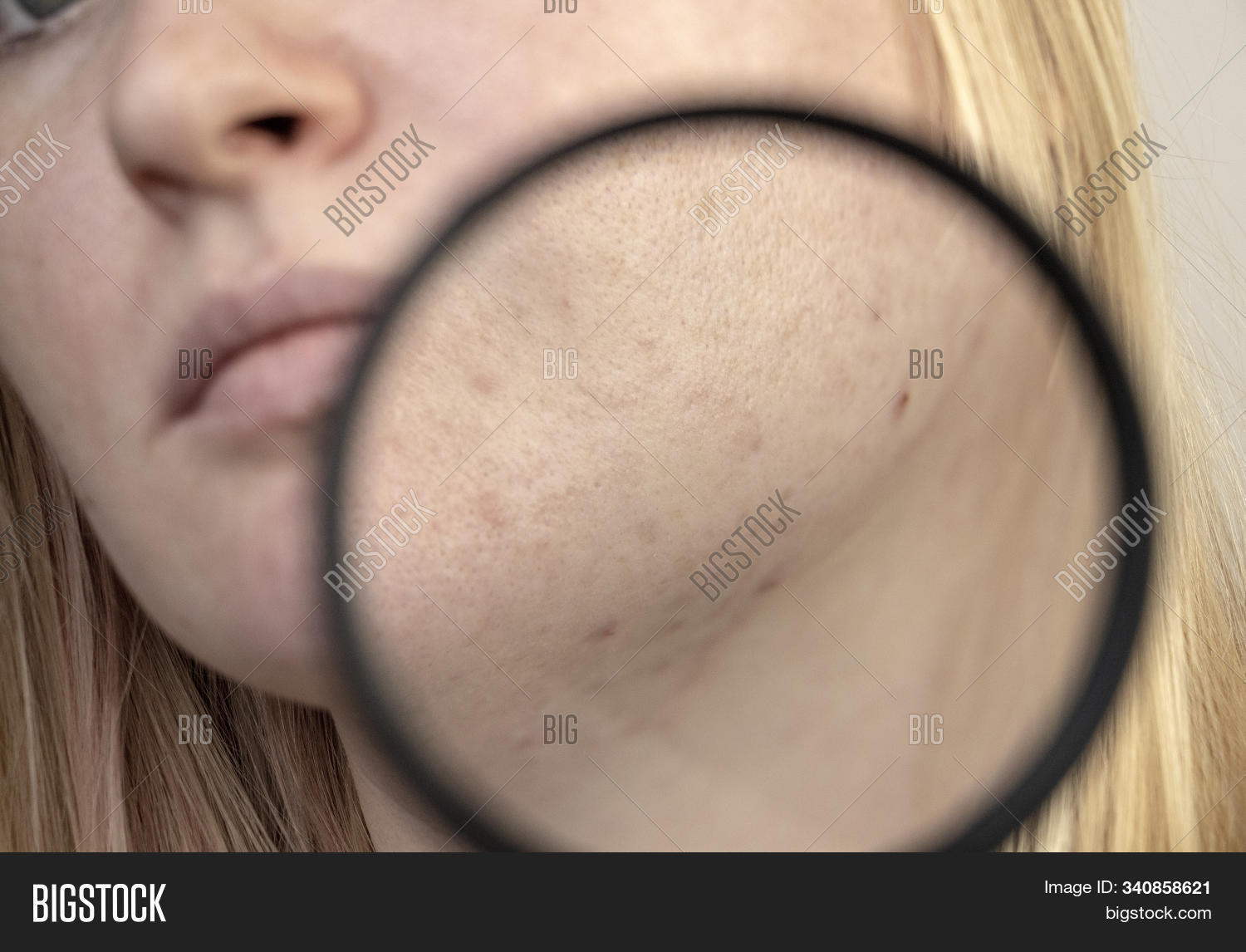 кожа через лупу