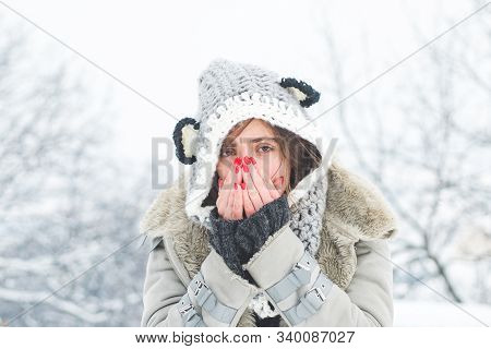 Young Woman With Nose Wiper Near Winter Tree. Woman With Napkin Sneezing In The Winter Snowy Park. Y