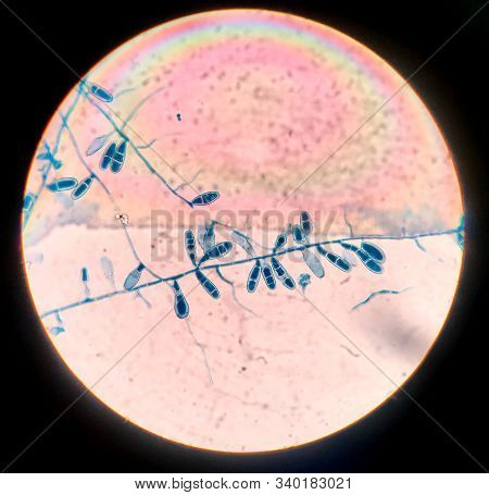 Close Up Macro Conidia Of Fungi.education Concept.