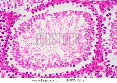 Human Sperm In The Testis Morphology Under Microscope. Micrograph Showing Spermatozoon For Pathology