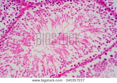 Human Sperm In The Testis Morphology Under Microscope. Micrograph Showing Spermatozoon For Pathology