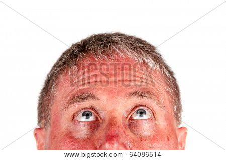 Man with a sunburn looking up