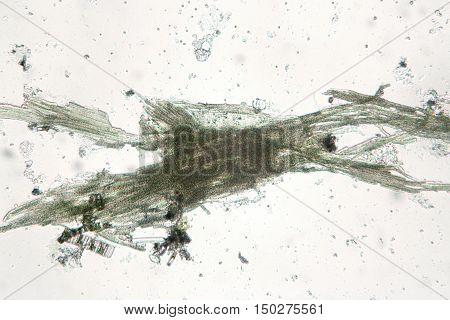 Freshwater cyanobacteria Aphanizomenon by microscope. The cause of algal blooms green water. The sample is pressed with a cover glass
