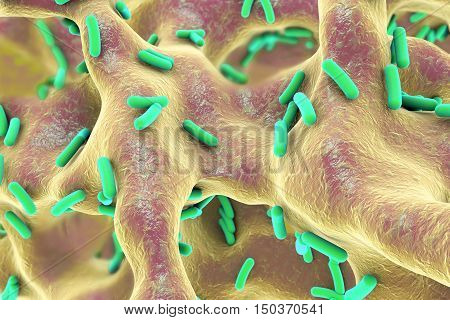 Rod-shaped bacteria inside bone tissue. Osteomyelitis, 3D illustration
