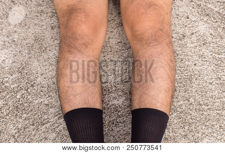 Asian Man Bandy-legged Shape Of The Legs,physiological Bow Leg,close Up