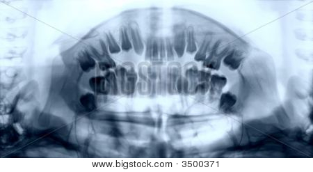 Radiografia a ganasce del popolo