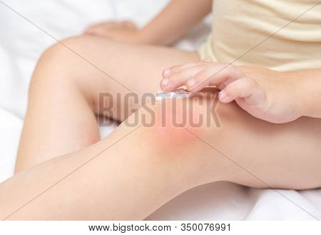 A Small Child Rubs A Childrens Healing Cream On The Skin Of A Knee. The Concept Of Treatment Of Skin