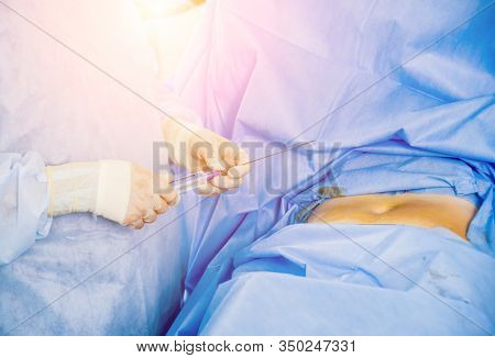 Arthroscope Surgery. Orthopedic Surgeons In Teamwork In The Operating Room