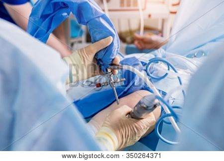 Arthroscope Surgery. Orthopedic Surgeons In Teamwork In The Operating Room