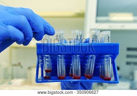 Medical Or Scientific Researcher Or Doctor Looking At A Test Tube With Liquid Red Solution In A Labo