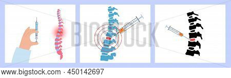 Spine Joint Injection. Pain And Inflammation In The Vertebra. Spinal Arthritis Disease Concept. Medi
