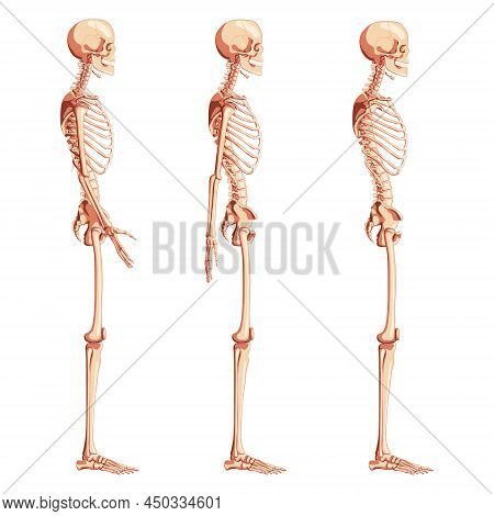 Skeleton Human Dorsal Side View With Armless, Open And Back Arm Poses. Set Of Realistic Medical Flat
