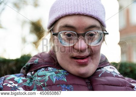Close Up Portrait Of A 39 Year Old White Woman With Down Syndrome