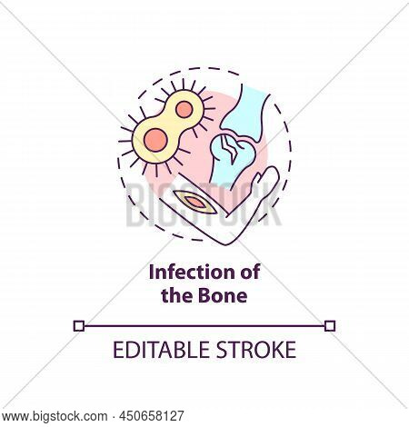 Infection Of Bone Concept Icon. Common Joint Condition Abstract Idea Thin Line Illustration. Osteomy