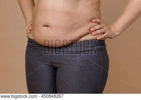 Front View Of Overweighted Thick Belly Of Woman Wearing Leggings. Body Positive. Violation Of Cell E