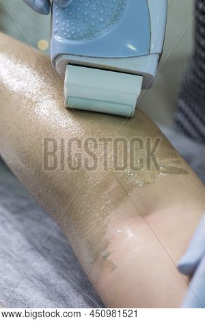 Depilation Spa Procedure. Woman Hair Remove Waxing. Epilation Sugaring. Legs Foot With Wax Melter.