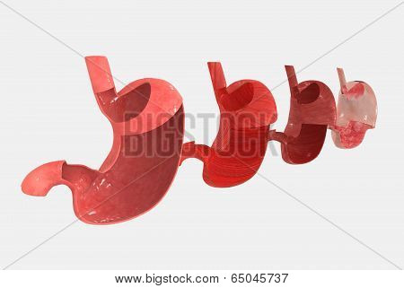 Stomach