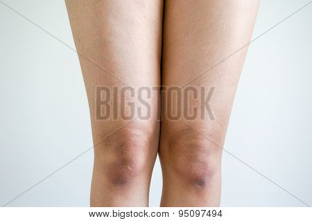 Thighs And Knees Of The Woman