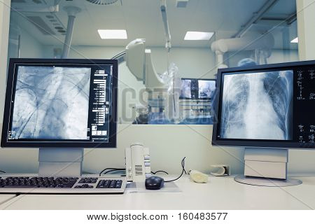 Working with patient in cathlab. Modern healthcare concept