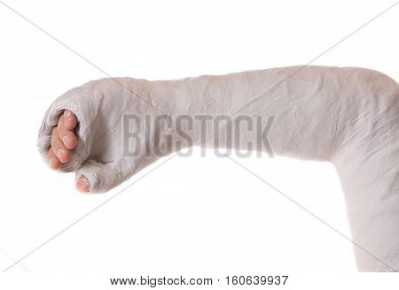 Young Man Wearing An Arm Cast After A Skating Accident
