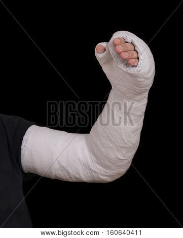Young Man Wearing A Long Arm Plaster Fiberglass Cast