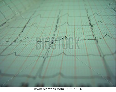 EKG
