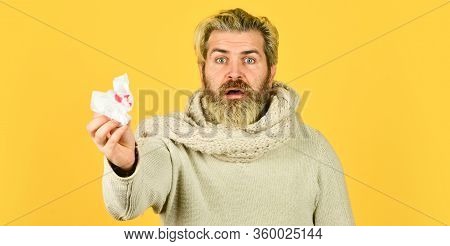 Look At That. Pneumonia. Sick Man Hold Napkin With Blood. Sickness Allergy Concept. Ill Man With Blo