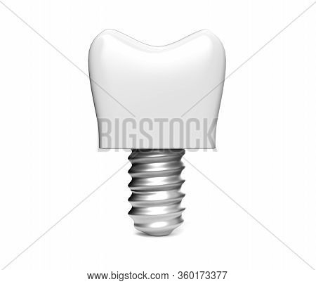 3d Render White Tooth Implant Denture Icon Set Closeup Isolated On White Background. Dental, Medicin