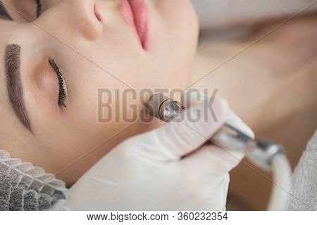 Diamond Microdermabrasion, Peeling Cosmetic. Woman During A Microdermabrasion Treatment In Beauty Sa