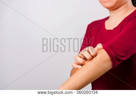 Asian Beautiful Woman Itching Her Scratching Her Itchy Arm On White Background With Copy Space, Medi