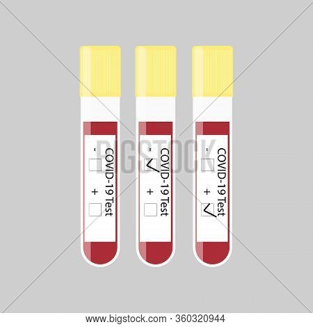 Laboratory Blood Test For Virus Covid19. Novel Coronavirus 2019-ncov Denoted Is Single-stranded Rna 