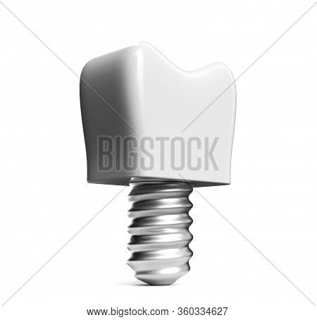 3d Render White Tooth Implant Denture Icon Set Closeup Isolated On White Background. Dental, Medicin
