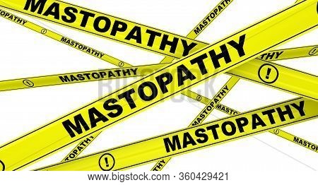 Mastopathy. Yellow Warning Tapes With Black Words Mastopathy (fibrocystic Breast Changes). Isolated.