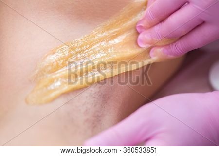 Master Of Sugaring Puts Paste On The Girls Armpits. Professional Woman At Spa Beauty Salon Doing Epi
