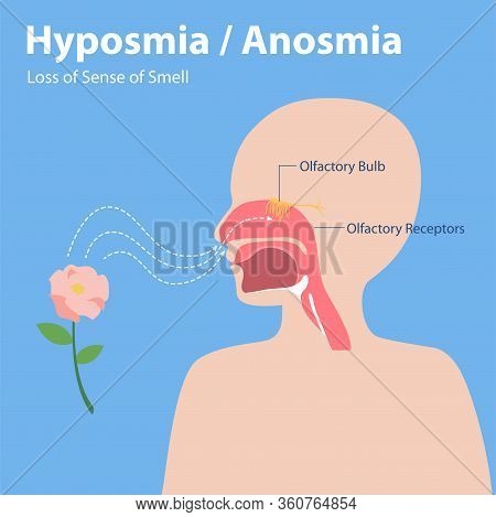 Hyposmia Anosmia, Loss Of Sense Of Smell Info Graphic Elements The Signs Of Corona Virus Symptoms , 