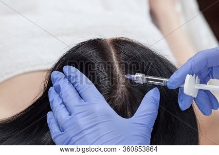Cosmetologist Does Prp Therapy Against Hair Loss And Anti-dandruff Of A Beautiful Woman In A Beauty 