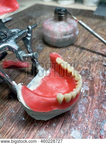 Artificial Dentures In The Manufacturing Steps In The Dental Lab. Dental Orthodontic Mold With Tools