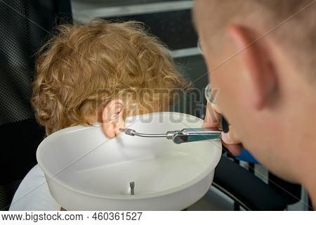To Wash Ears With Water Irrigator, An Experienced Doctor Substitutes A Special Funnel To Childs Ear 