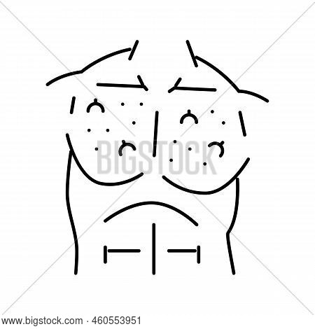Chest Ingrown Hair Line Icon Vector. Chest Ingrown Hair Sign. Isolated Contour Symbol Black Illustra