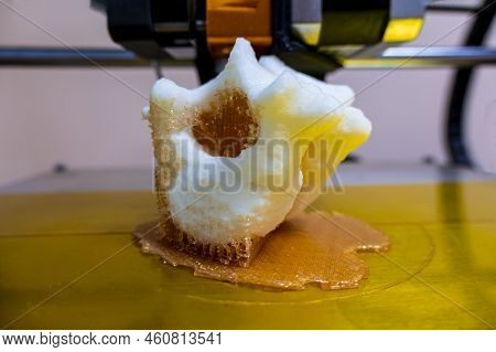 Printing Vertebrae On A 3d Printer. Artificial Body Parts Printed On A 3d Printer. New Era Of Medici